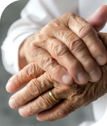 Arthritis Treatment
