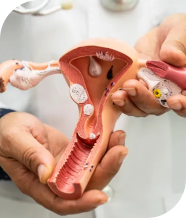 Gynecological issues