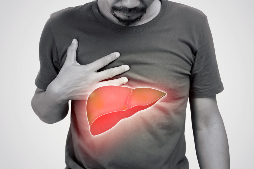 Fatty Liver Treatment in Ayurveda
