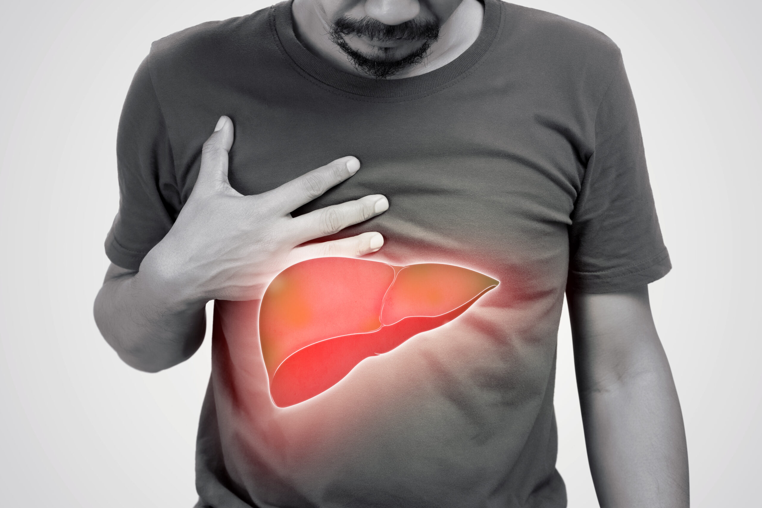 Fatty Liver Treatment in Ayurveda